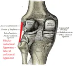 knee-lateral-collateral-ligament-sprain-physiotherapy