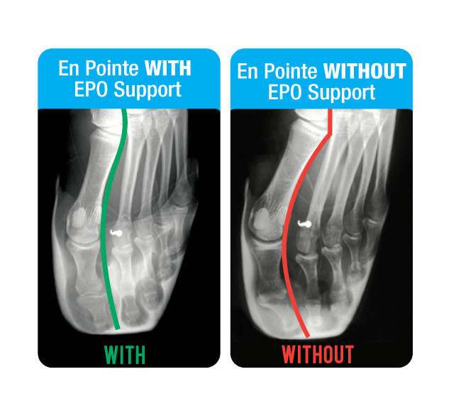 En Pointe Orthotics Customized Ballet Inserts Singapore