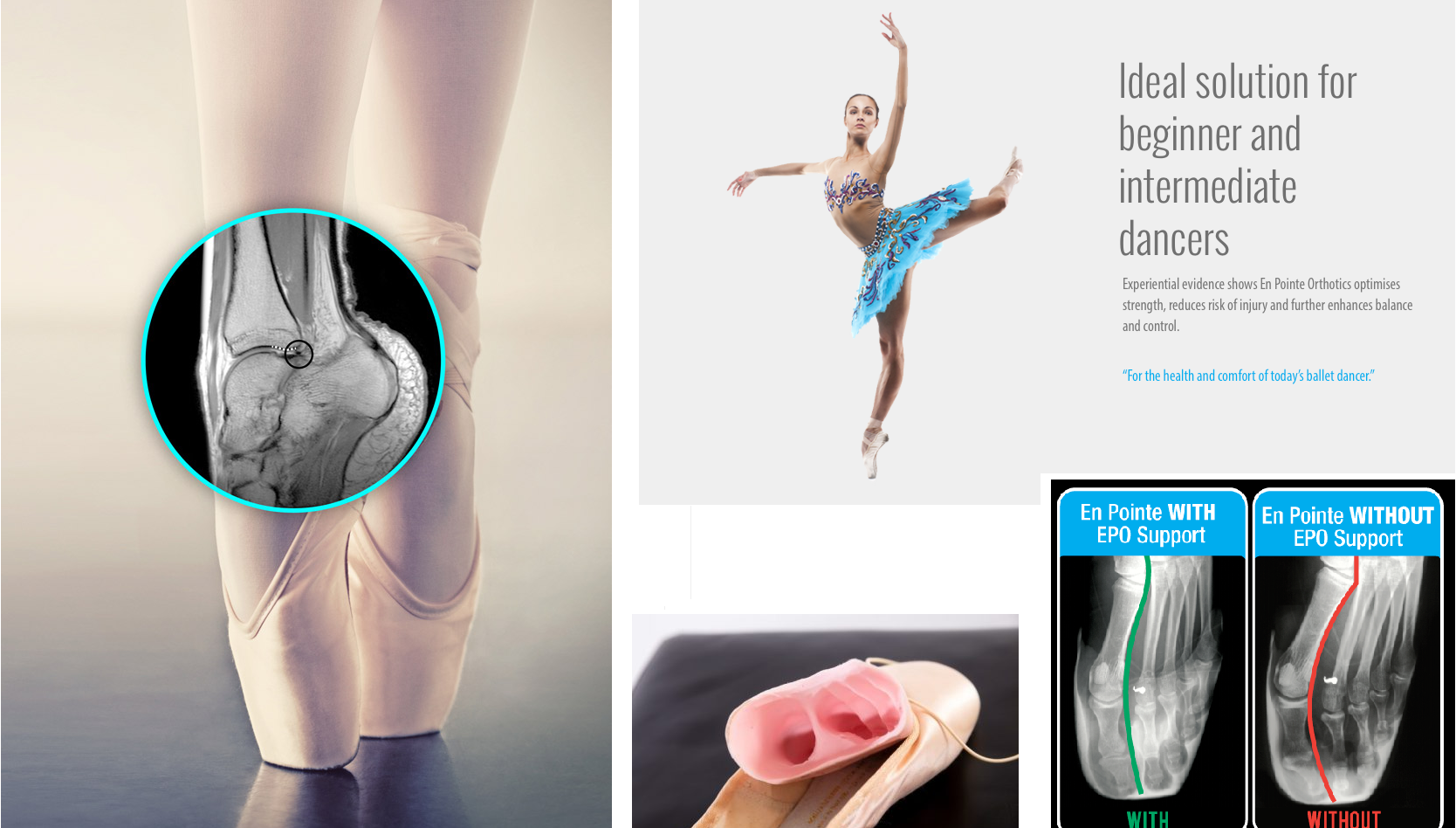 pointe shoe orthotics